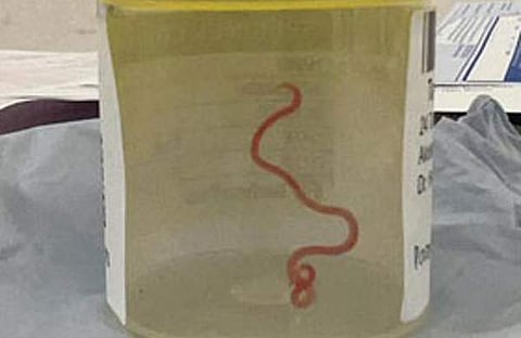 ഒഫിഡാസ്‌കറിസ് റോബര്‍ട്ട്‌സി/ എക്‌സ്