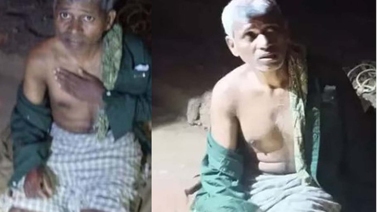 കാട്ടാന ആക്രമണത്തില് പരിക്കേറ്റ മാവോയിസ്റ്റിനെ യുഎപിഎ ചുമത്തി അറസ്റ്റ് ചെയ്യും