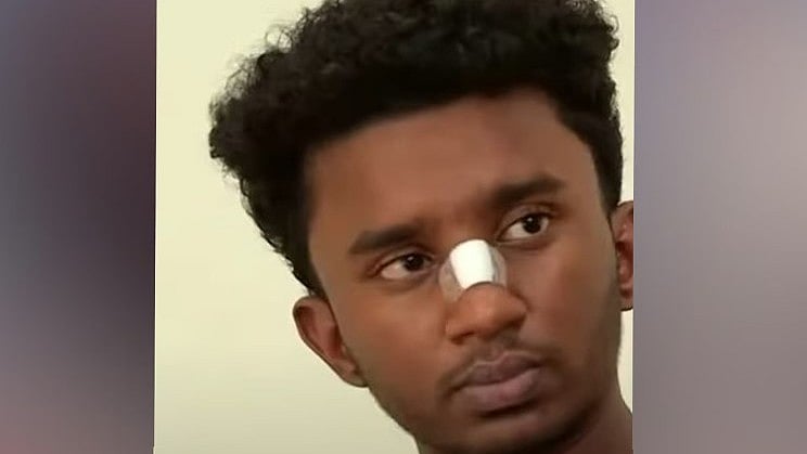 കൊയിലാണ്ടിയിൽ എസ്എഫ്ഐ പ്രവർത്തകരുടെ മർദ്ദനമേറ്റ സംഭവം; വിദ്യാർഥി ഇന്ന് പ്രിൻസിപ്പലിനു പരാതി നൽകും
