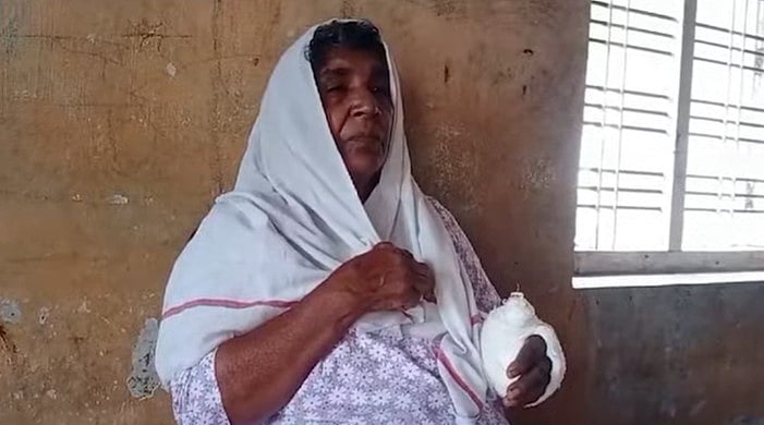 കൈ കഴുകാന്‍ വെള്ളം കോരി നല്‍കിയില്ല;  മകന്‍ അമ്മയുടെ കൈ തല്ലിയൊടിച്ചു