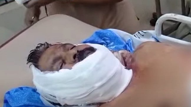 ഭര്‍ത്താവിനെ വെട്ടിക്കൊല്ലാന്‍ ശ്രമിച്ച് ഭാര്യ; കുളത്തില്‍ ചാടി ആത്മഹത്യാശ്രമം