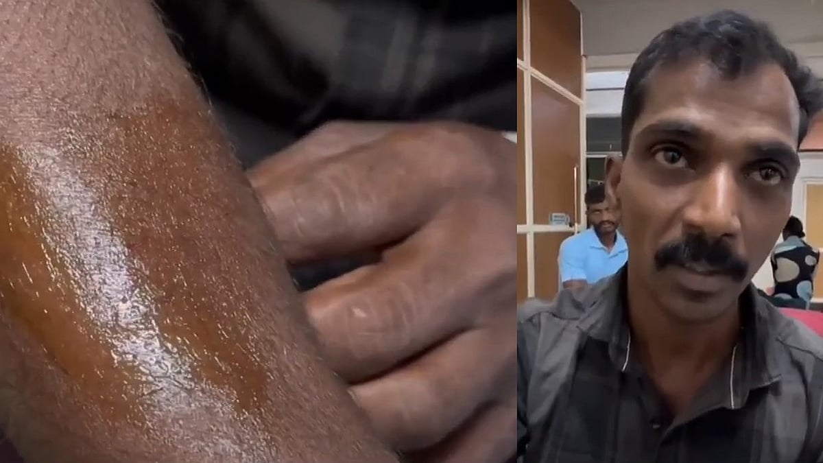 കാപ്പി ചെടിക്ക് മുകളിലൂടെ ചാടി വീണു; വയനാട്ടിൽ പുലിയുടെ ആക്രമണത്തിൽ യുവാവിന് പരിക്ക്