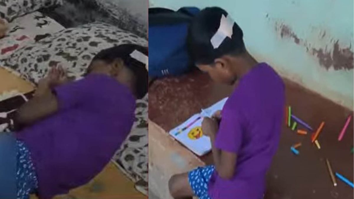 കാട്ടുപന്നിയുടെ ആക്രമണം; ആറു വയസുകാരിയെ ഇടിച്ചിട്ടു, കാലിലും തലയിലും പരിക്ക് 
