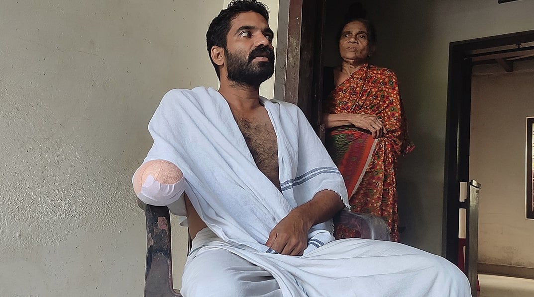 കുളം വൃത്തിയാക്കുന്നതിനിടെ മീന്‍ കൊത്തി, അണുബാധ; യുവാവിന്റെ വലത് കൈപ്പത്തി മുറിച്ചുമാറ്റി; വിഡിയോ