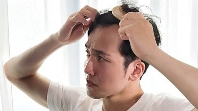 Hair Care: കഷണ്ടിത്തലയിലും ഇനി മുടി വളരും, പുതിയ പ്രോട്ടീന്‍ കണ്ടെത്തി