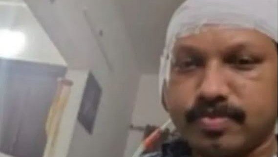 ഹെയര്‍ ട്രാന്‍സ്പ്ലാന്റേഷന് പിന്നാലെ തലയില്‍ പഴുപ്പ് നിറഞ്ഞു, കടുത്ത വേദന; ഗുരുതരാവസ്ഥയില്‍ യുവാവ് ആശുപത്രിയില്‍