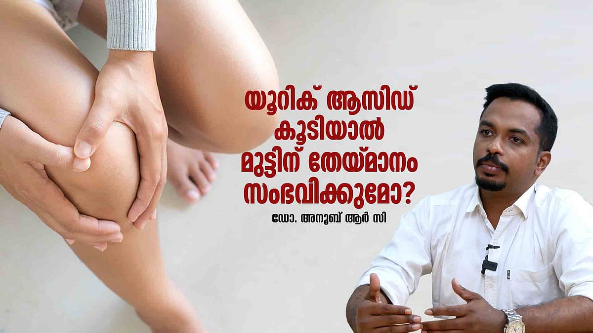 യൂറിക് ആസിഡ് കൂടിയാല്‍ മുട്ടിന് തേയ്മാനം സംഭവിക്കുമോ? റെഡ് മീറ്റ് കഴിക്കുന്നവര്‍ സൂക്ഷിക്കുക