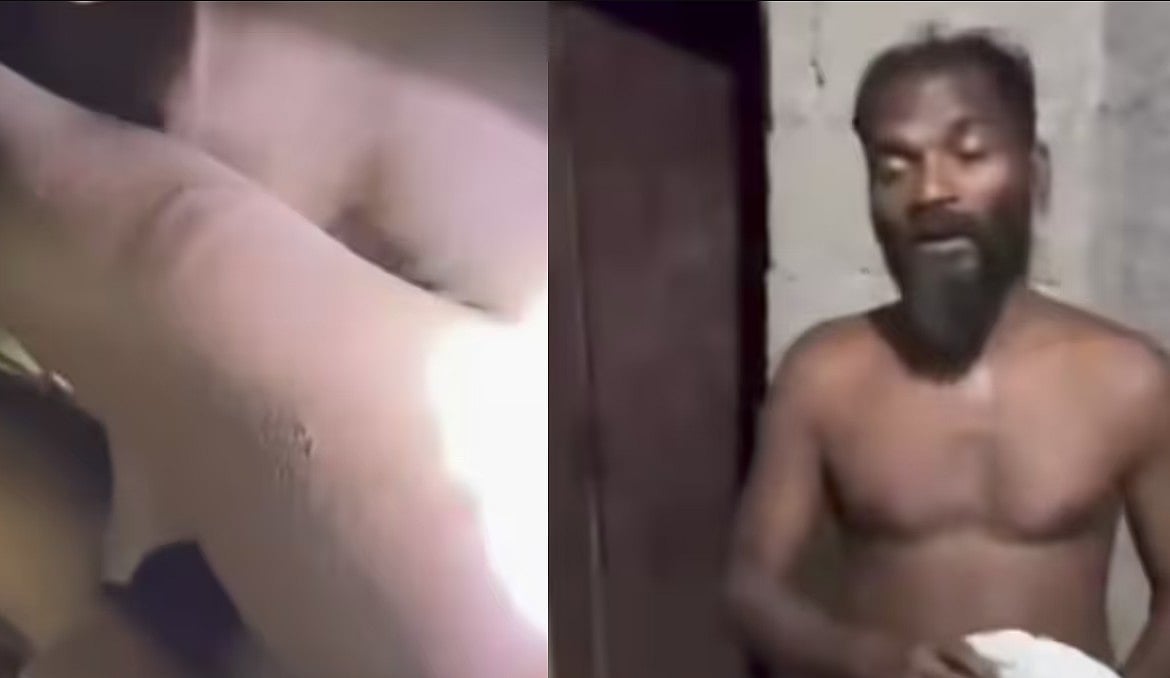 കോടാലി കൈ കൊണ്ട് പതിമൂന്നുകാരനായ മകനെ ക്രൂരമായി മര്‍ദ്ദിച്ചു; പിതാവ് അറസ്റ്റില്‍