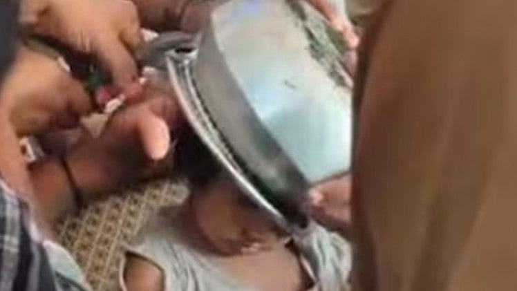 കളിക്കുന്നതിനിടെ അലുമിനിയം പാത്രം തലയില്‍ കുടുങ്ങി; രണ്ടു വയസുകാരിക്ക് രക്ഷകരായി അഗ്‌നിരക്ഷാസേന