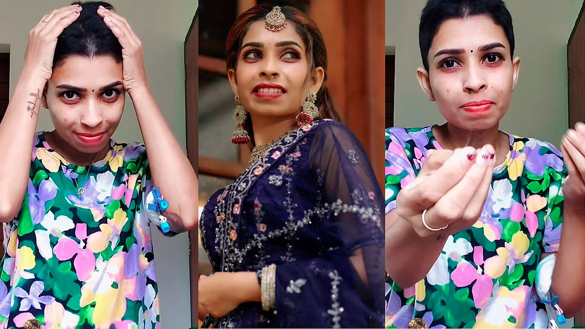 'കാന്‍സറില്ല, എല്ലാം സഹതാപത്തിന് വേണ്ടിയുള്ള അഭിനയം'; മുടി കൊഴിയുന്നത് ലൈവായി കാണിച്ച് രേണുവിന്റെ മറുപടി
