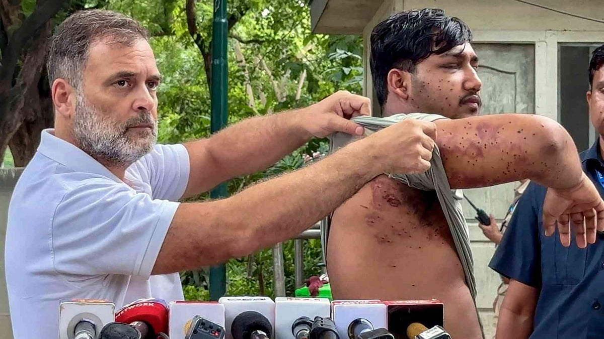 'കേന്ദ്രം നുണ പറയുന്നത് അവസാനിപ്പിക്കണം, ഇന്ത്യയുടെ ഭാവിക്കു നേരെയാണ് അവര്‍ വെടിയുതിര്‍ത്തത്‌'; പെല്ലറ്റ് ആക്രമണത്തിന് ഇരയായ വിദ്യാര്‍ഥിയെ ഒപ്പം നിര്‍ത്തി രാഹുല്‍ ഗാന്ധി