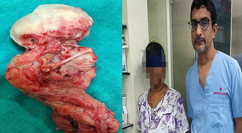 അസഹ്യമായ വയറുവേദനയുമായി ആശുപത്രിയിലെത്തി; സ്ത്രീയുടെ വയറ്റില്‍ നിന്ന് ഡോക്ടര്‍മാര്‍ പുറത്തെടുത്തത് 15 വര്‍ഷം മുന്‍പത്തെ ഭ്രൂണം