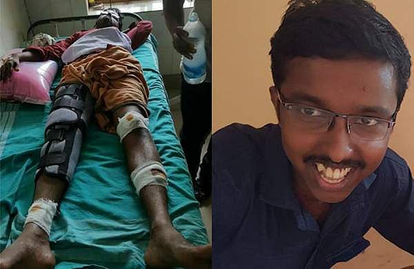 ആര്‍എംപി പ്രവര്‍ത്തകന് മര്‍ദ്ദനം; സിപിഎമ്മിനെതിരെ ഫെയ്‌സ്ബുക്കില്‍ നിരന്തരമായി പോസ്റ്റിട്ടതിന്റെ പ്രതികാരമെന്ന് ആരോപണം