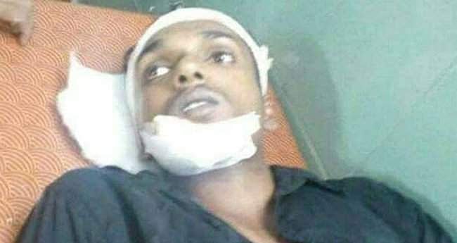 എസ്എഫ്‌ഐ പ്രവര്‍ത്തകരെ റോഡിലിട്ട് വെട്ടി; പരുക്കേറ്റത് മടപ്പള്ളി കോളേജ് യൂണിയന്‍ ഭാരവാഹികള്‍ക്ക്‌