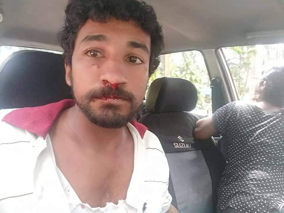 സിപിഎം കോഴിക്കോട് ജില്ലാ സെക്രട്ടറിയുടെ മകനും ഭാര്യയ്ക്കും ഹര്‍ത്താല്‍ അനുകൂലികളുടെ ക്രൂരമര്‍ദനം