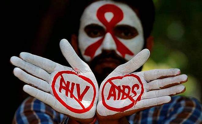ഉമിനീരിലൂടെ എയിഡ്‌സ് പകര്‍ത്തി ; ഡോക്ടറായ ഭര്‍ത്താവിനെതിരെ പരാതിയുമായി യുവതി