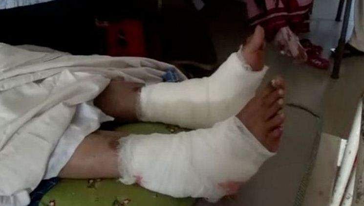ഇടത്തേ കാലിന് പകരം ശസ്ത്രക്രിയ ചെയ്തത് വലത്തേ കാലില്‍ ; സര്‍ക്കാര്‍ ആശുപത്രി ഡോക്ടര്‍ക്കെതിരെ പ്രതിഷേധം