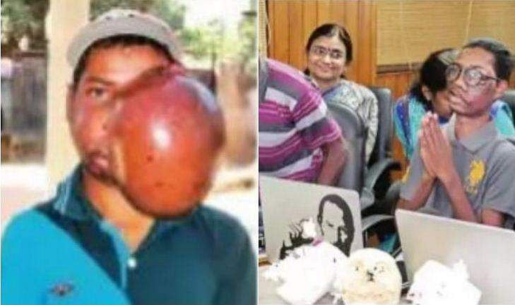 മുഖത്ത് വളര്‍ന്ന 4 കിലോയിലധികം ഭാരമുള്ള മുഴ നീക്കം ചെയ്തു; അമീറിന് ഇനി നല്ല നാളുകള്‍ 