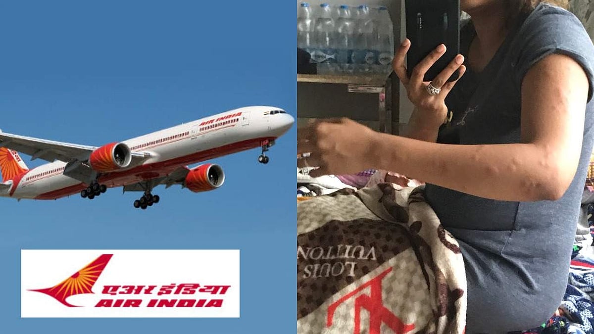 മൂട്ടകടിയേല്ക്കാനാണോ ബിസിനസ് ക്ലാസില് പണം തരുന്നത്? മൂട്ട കടിയേറ്റ് വീര്ത്ത കൈകളുമായി എയര്ഇന്ത്യക്ക് യുവതിയുടെ ട്വീറ്റ്