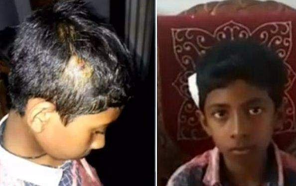 ക്ലാസില്‍ സംസാരിച്ചതിന് അഞ്ചാം ക്ലാസുകാരനെ മൊബൈല്‍ കൊണ്ട് തലയ്ക്കടിച്ചു; പ്രധാന അധ്യാപികയ്ക്ക് സസ്‌പെന്‍ഷന്‍