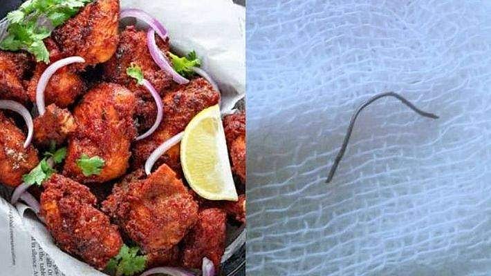 തട്ടുകടയില് നിന്ന് ചിക്കന്പൊരി കഴിച്ചു; തൊണ്ടയ്ക്ക് ഓപ്പറേഷന്; കുറിപ്പ്