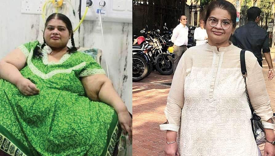 നാലുവര്‍ഷം മുമ്പ് 300 കിലോ, ഇപ്പോള്‍ 86 ; കിടന്ന കിടപ്പില്‍ നിന്നും സാധാരണ ജീവിതത്തിലേക്ക്, അവിശ്വസനീയം ഏഷ്യയിലെ ഏറ്റവും ഭാരമുള്ള സ്ത്രീയുടെ തിരിച്ചുവരവ്
