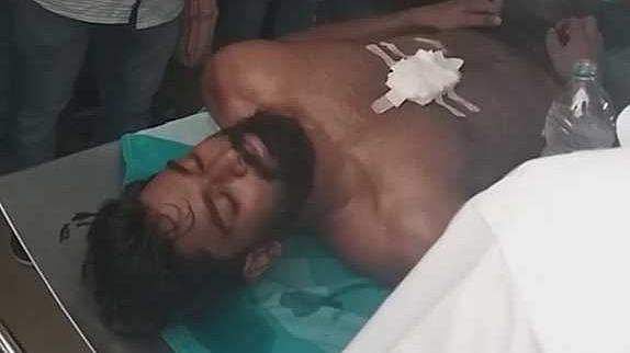 അഖിലിന്റെ മൊഴി ഇന്ന് രേഖപ്പെടുത്തും; ആരോ​ഗ്യ നിലയിൽ പുരോ​ഗതി