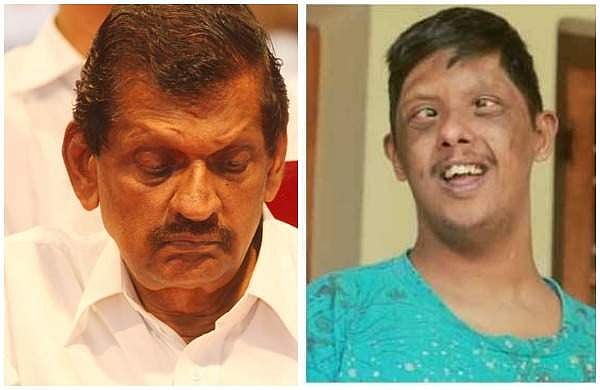 'അമ്മയ്ക്ക് 43 വയസ്സുള്ളപ്പോള് ജനനം; ഏഴു വയസ്സിനപ്പുറം ജീവിക്കില്ലെന്ന ഡോക്ടര്മാരുടെ പ്രവചനം, സ്നേഹിക്കാന് മാത്രമറിയുന്ന ജോക്കുട്ടന്'