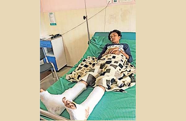 റോഡില്‍ നിന്ന് ഇറങ്ങി നടന്നില്ല; വിദ്യാര്‍ത്ഥിയെ ഇടിച്ചിട്ട് കാലുകളിലൂടെ കാര്‍ കയറ്റിയിറക്കി, ഗുരുതര പരിക്ക്