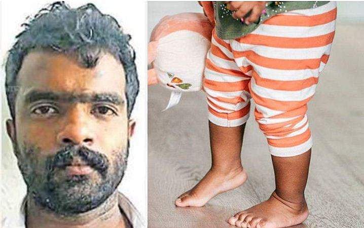 രണ്ടു വയസുകാരനെ സി​ഗരറ്റുകൊണ്ട് പൊള്ളിച്ച് അച്ഛൻ; ക്രൂരത സ്ത്രീധനത്തിന്റെ പേരിൽ; അറസ്റ്റ്