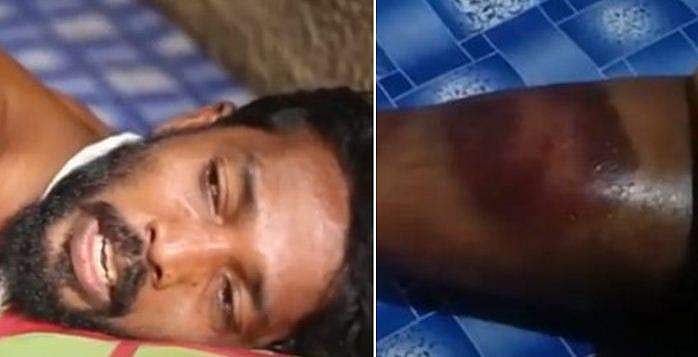 യുവാവിനെ കസ്റ്റഡിയിലെടുത്ത് ക്രൂരമായി മർദ്ദിച്ചു; പൂവാർ എസ്ഐയ്ക്ക് സസ്പെൻഷൻ; വകുപ്പുതല അന്വേഷണം