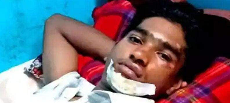 കയറുന്നതിന് മുന്‍പ് വാതിലടച്ചു; സ്വകാര്യ ബസില്‍ നിന്ന് വീണ് വിദ്യാര്‍ത്ഥിക്ക് പരിക്ക്‌