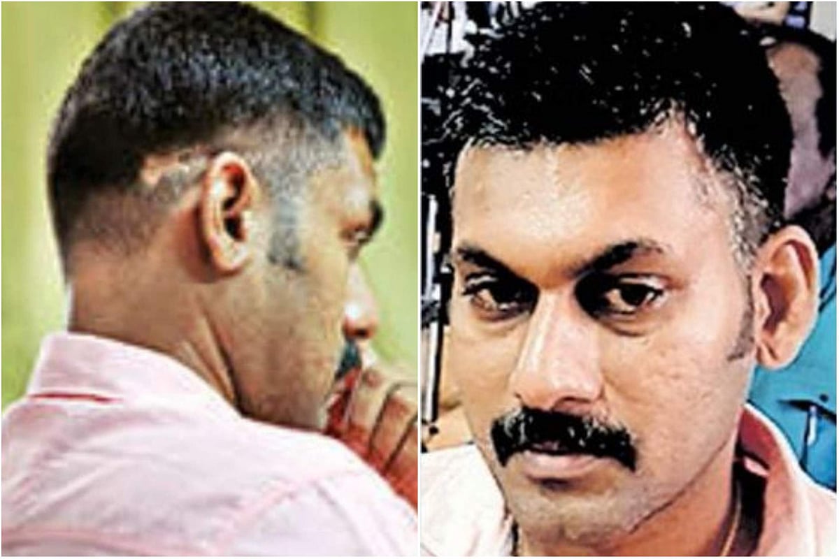 തലച്ചോറില്‍ നാലു വെടിയുണ്ടകളുമായി ആറുമാസം; അത്യപൂര്‍വ ശസ്ത്രക്രിയയിലൂടെ യുവാവ് വീണ്ടും ജീവിതത്തിലേക്ക് 