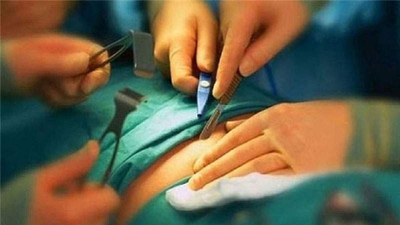 ചികിത്സയ്ക്കിടെ യുവതിയുടെ രണ്ടു വൃക്കകളും നീക്കി, പകരം ഡോക്ടറുടേത് വേണം; ആവശ്യവുമായി സര്‍ക്കാരിന് മുന്നില്‍ 