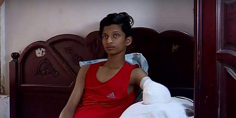 കളിക്കുന്നതിനിടെ വീണ് എല്ല് പൊട്ടി, ചികിത്സാ പിഴവിനെ തുടർന്ന് വിദ്യാർത്ഥിയുടെ കൈ മുറിച്ചുമാറ്റി; തലശ്ശേരി ജനറൽ ആശുപത്രിക്കെതിരെ പരാതി