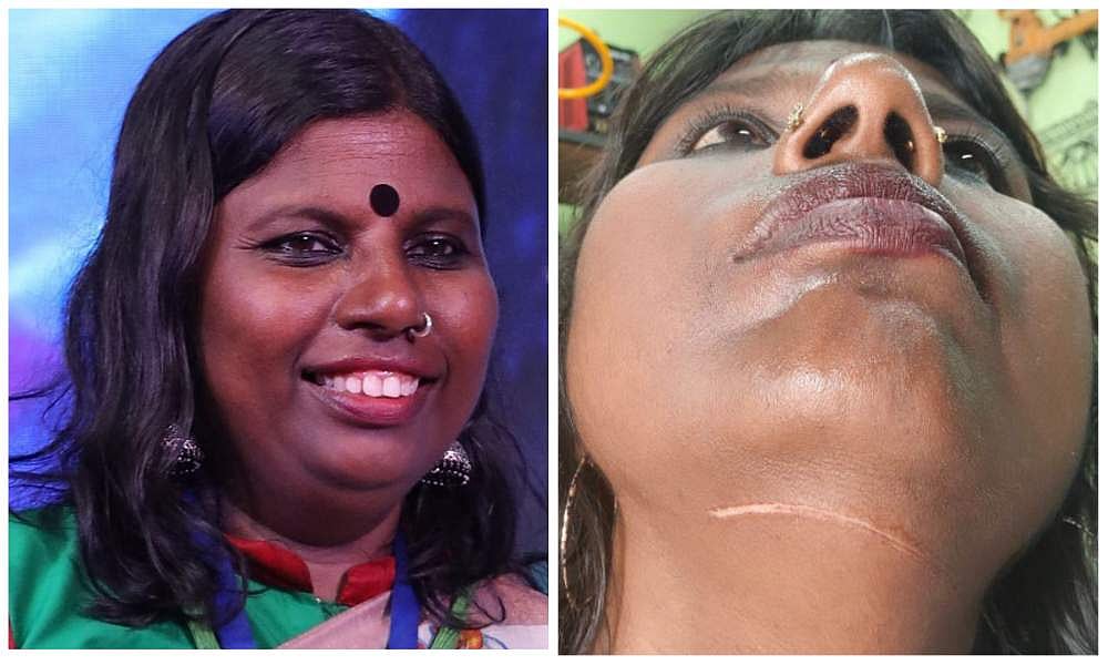സമ്മേളനത്തിന്റെ തോരണം കഴുത്തില്‍ കുരുങ്ങി; ബൈക്ക് യാത്രികയായ അഭിഭാഷകയ്ക്ക് പരിക്ക്; പരാതി