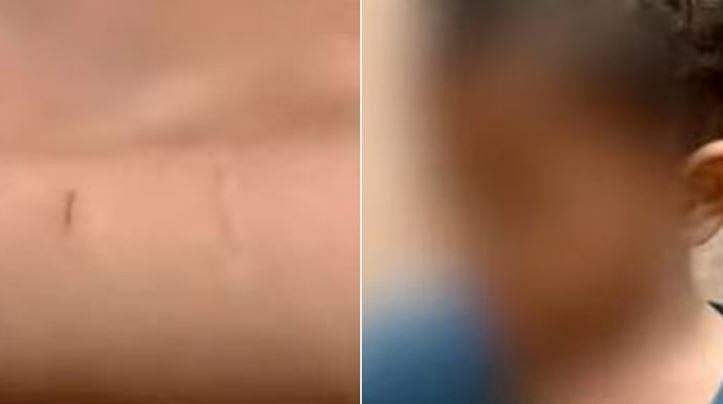 'പോടാ' എന്നു വിളിച്ചു; മൂന്നര വയസുകാരനെ കെട്ടിയിട്ട് മർദ്ദിച്ചു, പച്ച മുളക് തേക്കാൻ ശ്രമം; അങ്കൺവാടി ആയക്കെതിരെ പരാതി