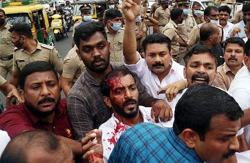 തൃശൂരിൽ ഡിസിസി മാർച്ച് അക്രമാസക്തം; യൂത്ത് കോൺഗ്രസ് മുൻ ജില്ല സെക്രട്ടറിയുടെ തലയ്ക്ക് പരിക്ക് (വീഡിയോ)