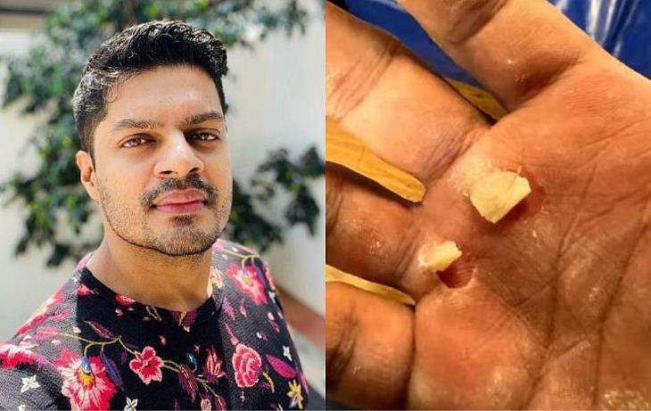 പുതിയ വൈറസ് വകഭേദമല്ലെന്ന് തെളിയിക്കാൻ ഈ വിഡിയോ കാണിക്കേണ്ടിവന്നു: സുദേവ് നായർ 