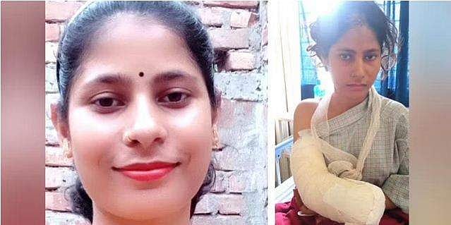 ഭാര്യയ്ക്ക് സര്‍ക്കാര്‍ ജോലി ലഭിച്ചതില്‍ അസൂയ; യുവതിയുടെ കൈപ്പത്തി വെട്ടിമാറ്റി ഭര്‍ത്താവ്