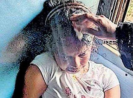 സാമൂഹ്യ ദ്രോഹികളുടെ ക്രൂരത വീണ്ടും; ട്രെയിനിൽ പുറം കാഴ്ചകൾ കാണുന്നതിനിടെ കല്ലേറ്; 12കാരിയുടെ തലയ്ക്ക് പരിക്ക്