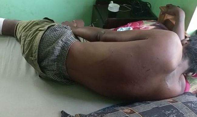 തിരുവനന്തപുരത്ത് പൊലീസുകാര്‍ക്ക് നേരെ ഗുണ്ടാ ആക്രമണം, മഴുവും ബോംബും എറിഞ്ഞു; പ്രതി ആത്മഹത്യയ്ക്ക് ശ്രമിച്ചു