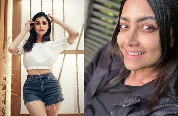 'എനിക്ക് നിറം നഷ്ടപ്പെടുന്നു'; രോ​ഗാവസ്ഥ പങ്കുവച്ച് മംമ്ത മോഹൻദാസ്