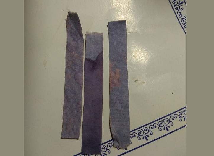 കൊച്ചിയില്‍ പെയ്ത മഴയില്‍ 'ആസിഡ് സാന്നിധ്യം'