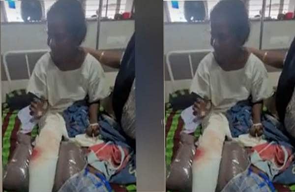 തുണി കൊണ്ട് മുഖം മറച്ചു; കമ്പിപ്പാര കൊണ്ട് കാല്‍ തല്ലിയൊടിച്ചു; തിരുവനന്തപുരത്ത് വയോധികയ്ക്ക് ക്രൂരമര്‍ദനം