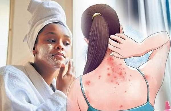 മഴക്കാലത്ത് ചർമ്മരോഗങ്ങൾ പതിവ്, എങ്ങനെ തടയാം?; മുൻകരുതലുകൾ മറക്കരുത്