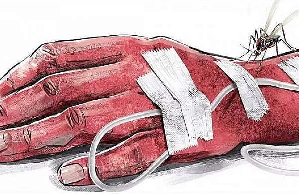 ഡെങ്കിപ്പനിയും മലേറിയയും ഒന്നിച്ചുവന്നാല്‍? ഇരട്ടി ഗുരുതരം, അത്യാഹിതമായി കരുതണം  